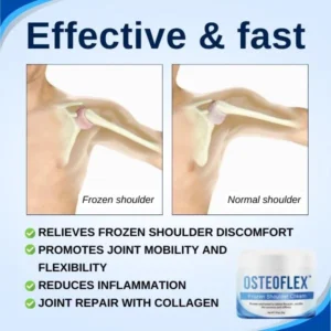 OsteoFlex™ Frozen Shoulder Cream