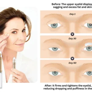 Oveallgo™ Eyelid Tightening Cream