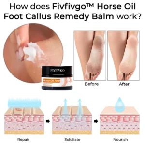 Oveallgo™ Horse Oil Foot Callus Remedy Balm