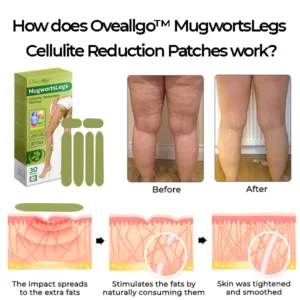 Oveallgo™ MugwortsLegs FIRM Cellulite Reduction Patches