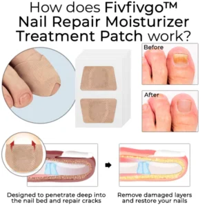 Oveallgo™ Nail Repair Moisturizer Treatment Patch