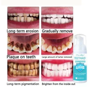 Oveallgo™ PRO Intensive Stain Removal Oral Cleansing Mousse