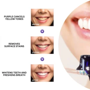 Oveallgo™ PRO Whitening Purple Mousse Toothpaste