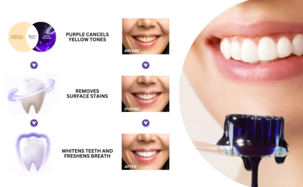 Oveallgo™ PRO Whitening Purple Mousse Toothpaste