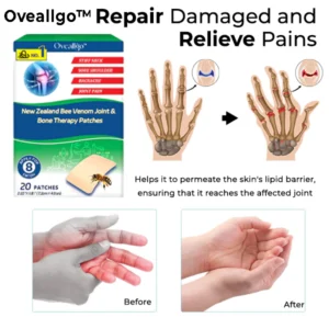 Oveallgo™ Parches de terapia para articulaciones y huesos con veneno de abeja de Nueva Zelanda