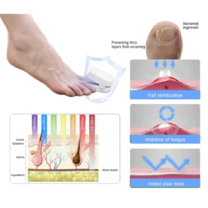 Oveallgo™ Revolutionary High-Efficiency Light Therapy Device For Toenail Diseases