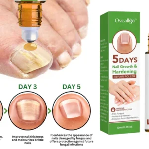 Oveallgo™ Rodillo reparador de endurecimiento y crecimiento de uñas de 5 días