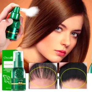 Oveallgo™ ShougaGRO Japanisches Haarwachstumsspray