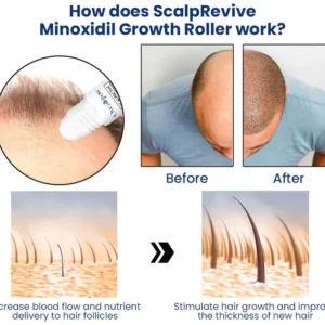 Oveallgrow™ ScalpRevive Minoxidil Growth Roller