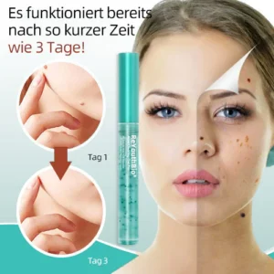 ReYouthBio® Etiketten- und Muttermale-Entferner