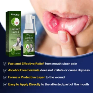 SOUTH MOON™ Canker Sores Spray