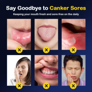 SOUTH MOON™ Canker Sores Spray