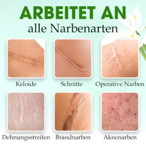 SkinFix™ Narbenreparatur-Essenz