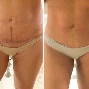 SkinFix™ Narbenreparatur-Essenz