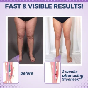 Sleemex™ Overnight Slimming Compression Socks