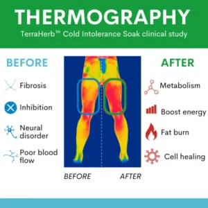 TerraHerb™ Cold Intolerance Soak