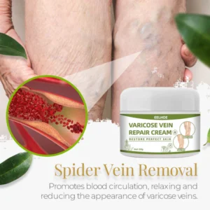 Varicose Vein Repair Cream