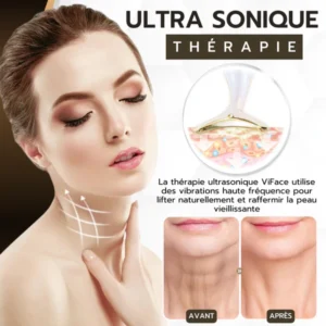 ViFace Lifting Facial Ultrasonique