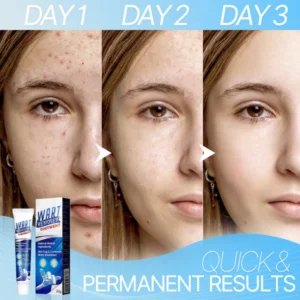 WART-LESS Immediate Blemish Removal Cream