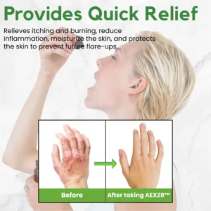 AEXZR™ Eczema Herbal Drops