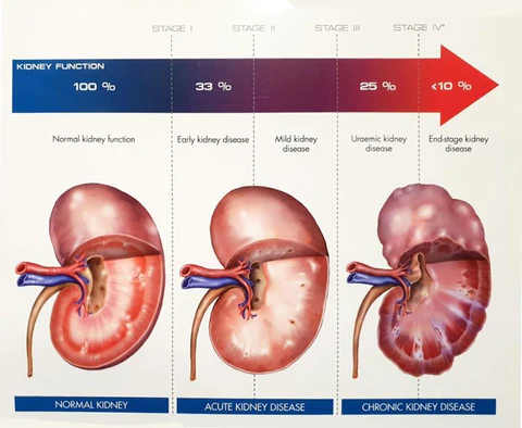 ASYRX Multi-Functional Kidney Care Patch