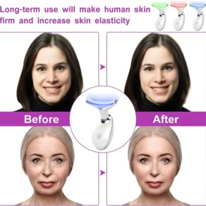 EMS FACE LIFTING MASSAGER