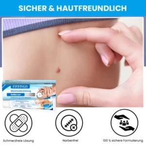 Fivfivgo™ MaximaleLeistung Salbe zur sofortigen Entfernung von Warzen