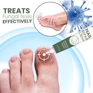 Oveallgo™ LifeMed Home Use Onychomycosis Fungal Laser Treatment