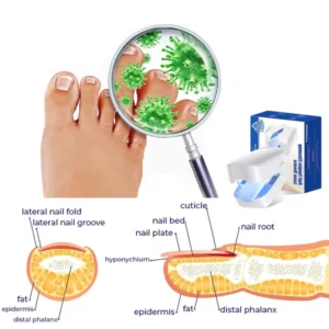 Oveallgo™ Revolutionary PharmaPro High-Efficiency Light Therapy Device For Toenail Diseases