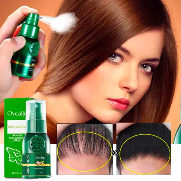 Oveallgo™ ShougaGRO Advanced Japanese Hair Growth Spray - Image 4