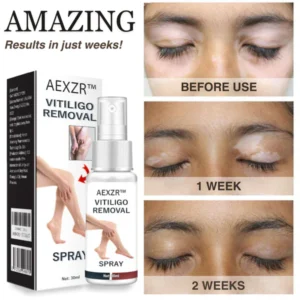 AEXZR™ Vitiligo Removal Spray