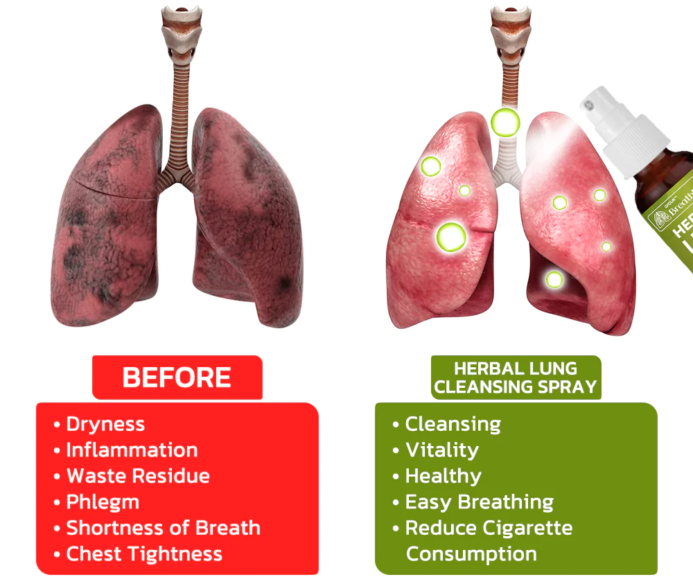 CC™️ BreathDetox Herbal Lung Cleansing Spray