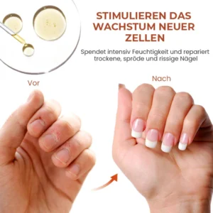 Fivfivgo™ 7 Tage Maximale Stärke Nagel-Reparatur-Serum