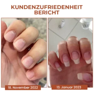 Fivfivgo™ 7 Tage Maximale Stärke Nagel-Reparatur-Serum