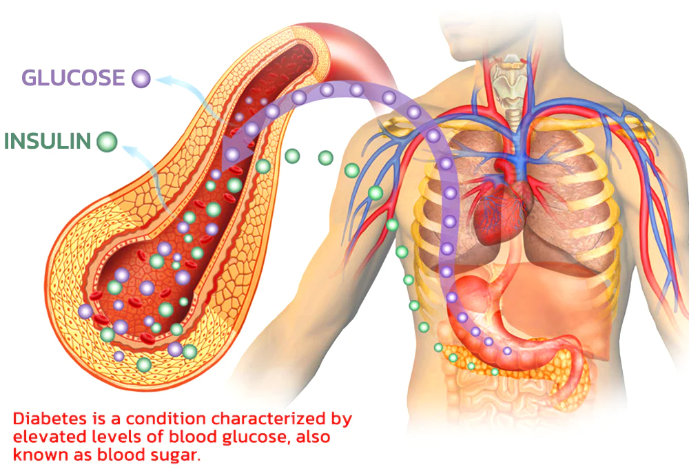 GFOUK™ GlucoSync Health Control Aerosolizer