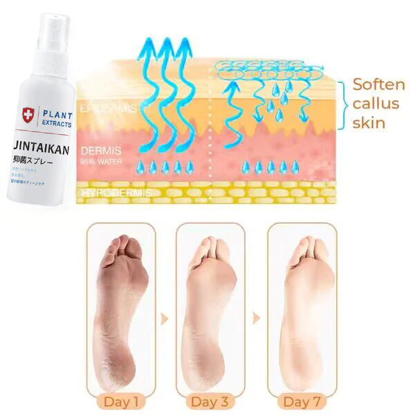 Morning Light Lucky Star Antifungal Foot Spray