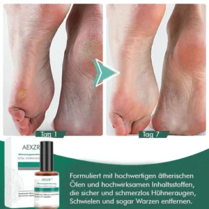 AEXZR™ Hühneraugenentfernung Extra Starkes Gel