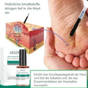 AEXZR™ Hühneraugenentfernung Extra Starkes Gel