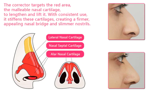 Biancat™ Magic Nose Shaper Device