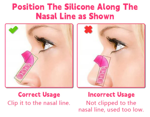 Biancat™ Magic Nose Shaper Device