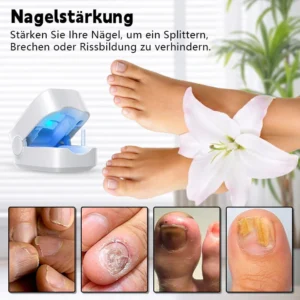 Biancat™ Nagelpilz-Infektionsreparaturgerät