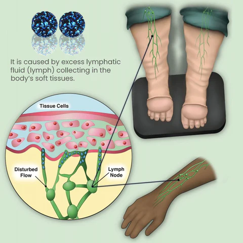 CZTICLE™Magnetologie Lymphvity Germanium Ohrringe