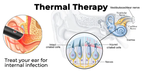 Fivfivgo™ DrWave Tinnitus NerveTreat Thermal Pen