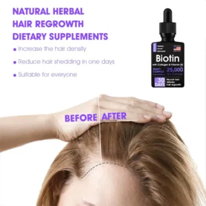 Fivfivgo™ Hair Follicle Repair Hair Growth Drops - Achieve thicker hair quickly