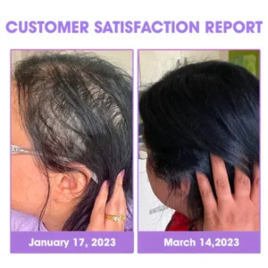 Fivfivgo™ Hair Follicle Repair Hair Growth Drops - Achieve thicker hair quickly