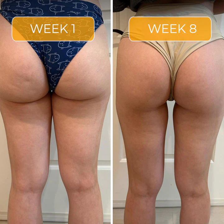 Fivfivgo™ Straffende Anti-Cellulite-Seife