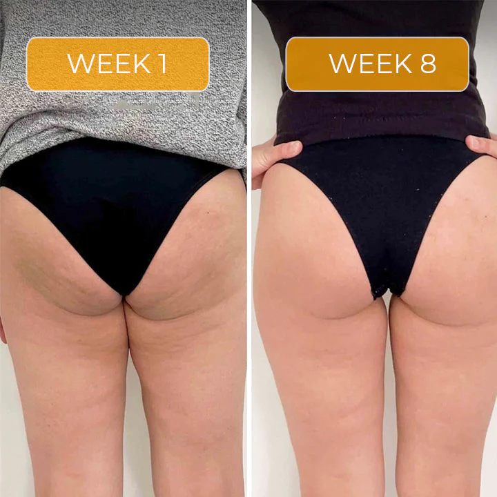 Fivfivgo™ Straffende Anti-Cellulite-Seife