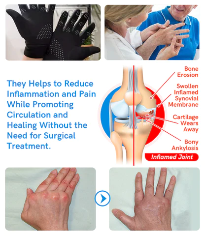 GFOUK™ IONHEAT Joint and Bone Therapy Gloves