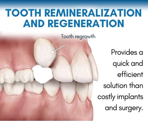 GFOUK™ Shark Cartilage Protein Dental Regrowth Drops