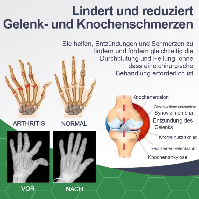 LERCEA™ Bienengift Schmerz- und Knochenheilung